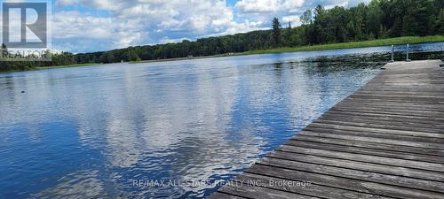 136 Coldstream Road, Kawartha Lakes, ON - Outdoor With Body Of Water With View