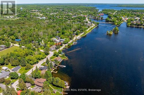 178 Front Street W, Kawartha Lakes (Bobcaygeon), ON - Outdoor With Body Of Water With View