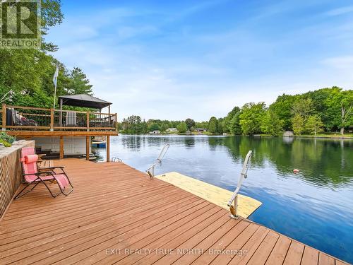 79 Stanley Street, Kawartha Lakes, ON - Outdoor With Body Of Water With Deck Patio Veranda With View