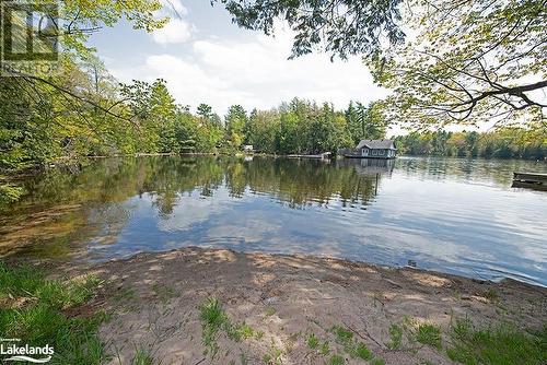 285 Huron Trail, Port Severn, ON - Outdoor With Body Of Water With View
