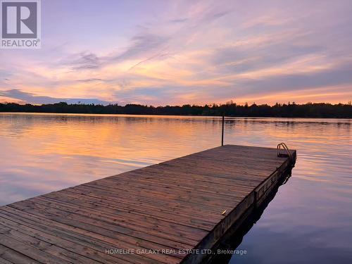 15 Restnook Lane, Whitchurch-Stouffville, ON - Outdoor With Body Of Water With View