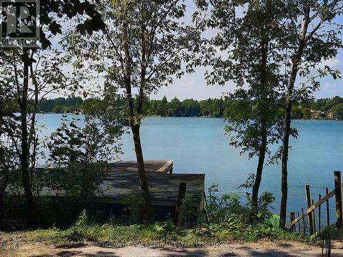 15 Restnook Lane, Whitchurch-Stouffville, ON - Outdoor With Body Of Water With View