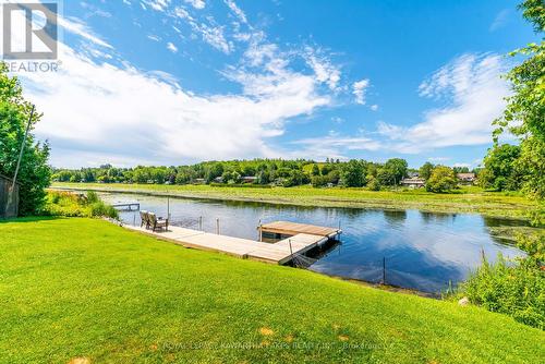 28 Cadillac Boulevard, Kawartha Lakes, ON - Outdoor With Body Of Water With View