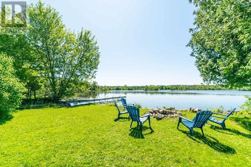 159 Mcguire Beach Road, Kawartha Lakes, ON - Outdoor With Body Of Water With View