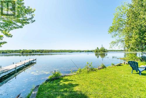 159 Mcguire Beach Road, Kawartha Lakes, ON - Outdoor With Body Of Water With View