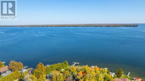 16 Cedar Dale Drive, Kawartha Lakes (Kirkfield), ON - Outdoor With Body Of Water With View