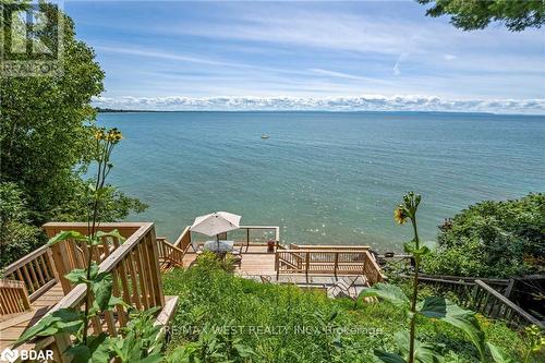 38 Willow Drive, Tiny, ON - Outdoor With Body Of Water With View