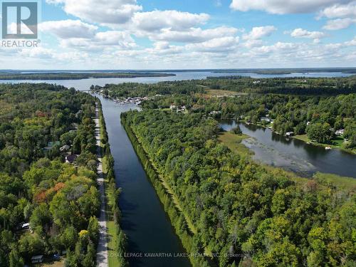 34 Deweys Island, Kawartha Lakes, ON - Outdoor With Body Of Water With View