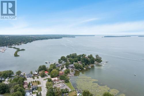 183 Cedar Island Road, Orillia, ON - Outdoor With Body Of Water With View