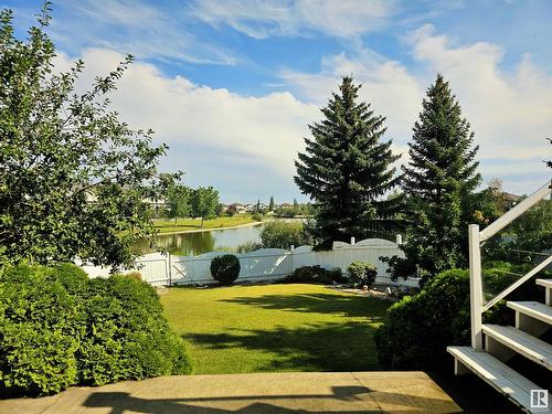 15821 132 St Nw, Edmonton, AB - Outdoor With View