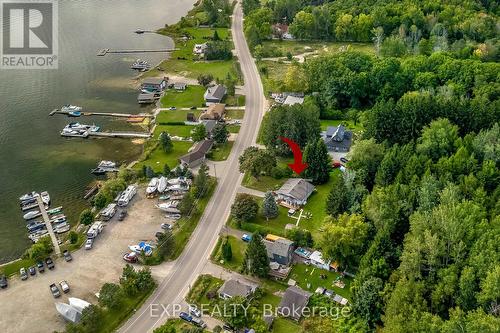 304 Champlain Road, Penetanguishene, ON - Outdoor With View