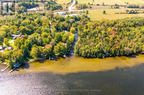 31 Jubbs Shore Road, Kawartha Lakes, ON - Outdoor With View