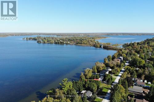 59 Antiquary Road S, Kawartha Lakes (Kirkfield), ON - Outdoor With Body Of Water With View