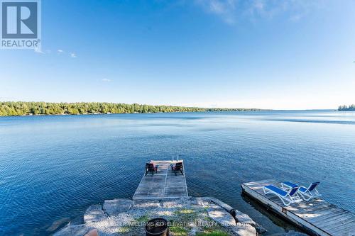 1144 North Bay Drive, Kawartha Lakes, ON - Outdoor With Body Of Water With View