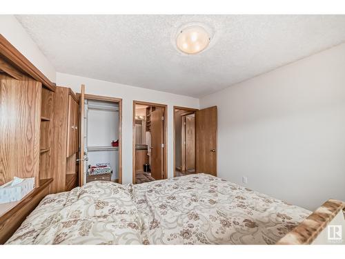 15907 91 St Nw, Edmonton, AB - Indoor Photo Showing Bedroom