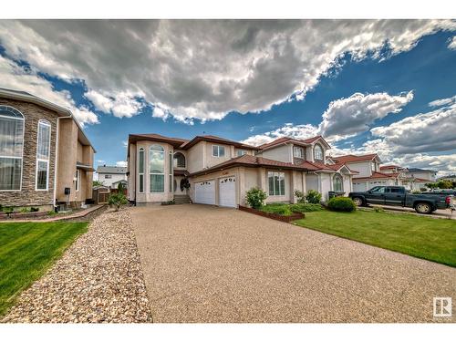 15907 91 St Nw, Edmonton, AB - Outdoor With Facade