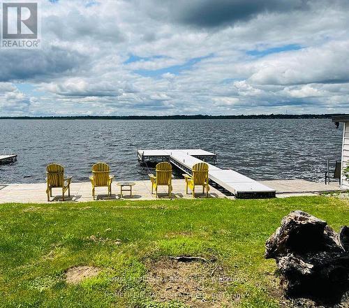 213 Snug Harbour Road, Kawartha Lakes, ON - Outdoor With Body Of Water With View