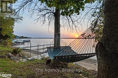 119 Campbell Beach Road, Kawartha Lakes, ON - Outdoor With View