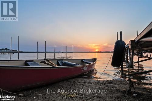 119 Campbell Beach Road, Kawartha Lakes, ON - Outdoor With Body Of Water With View