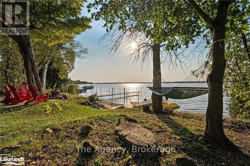 119 Campbell Beach Road, Kawartha Lakes, ON - Outdoor With Body Of Water With View