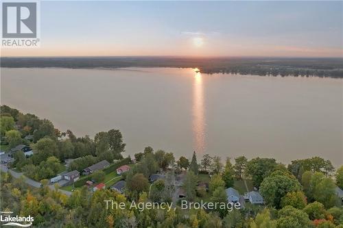 119 Campbell Beach Road, Kawartha Lakes, ON - Outdoor With Body Of Water With View