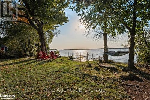 119 Campbell Beach Road, Kawartha Lakes, ON - Outdoor With Body Of Water With View