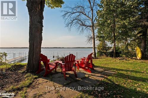 119 Campbell Beach Road, Kawartha Lakes, ON - Outdoor With Body Of Water With View