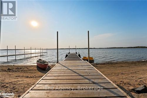 119 Campbell Beach Road, Kawartha Lakes, ON - Outdoor With Body Of Water With View