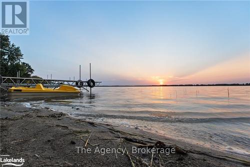 119 Campbell Beach Road, Kawartha Lakes, ON - Outdoor With Body Of Water With View