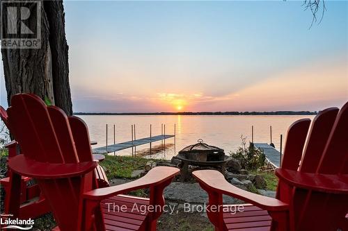 119 Campbell Beach Road, Kawartha Lakes, ON - Outdoor With Body Of Water With View