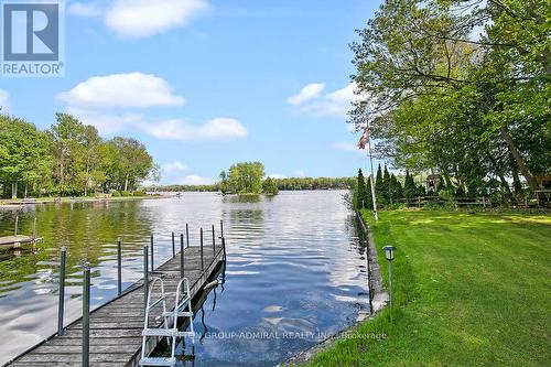 116 Mystic Point Road, Galway-Cavendish And Harvey, ON - Outdoor With Body Of Water With View