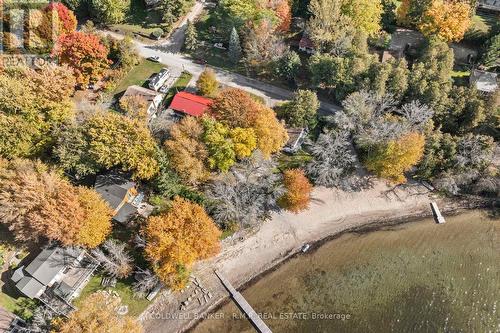 325 Lake Dalrymple Road, Kawartha Lakes, ON - Outdoor With View