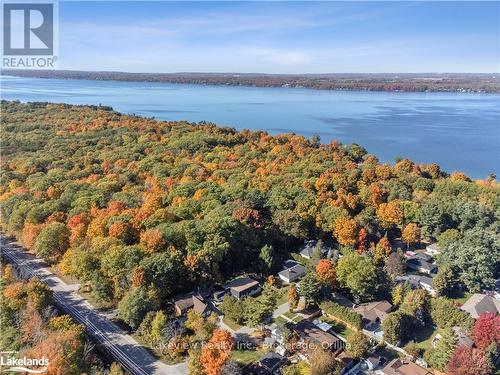 3914 Rosemary Lane, Innisfil, ON - Outdoor With Body Of Water With View