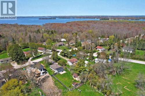 3965 Hilltop Road, Ramara, ON - Outdoor With Body Of Water With View