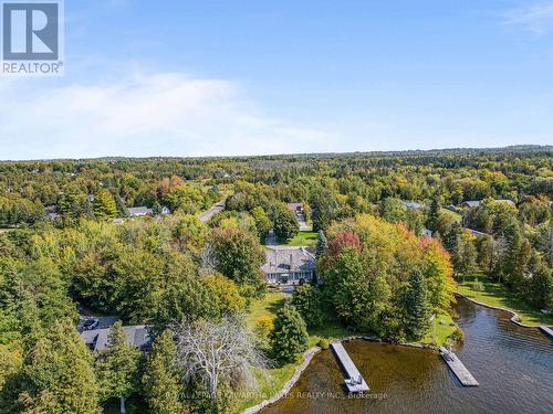 4 Sturgeon Glen Road, Kawartha Lakes (Fenelon Falls), ON - Outdoor With Body Of Water With View