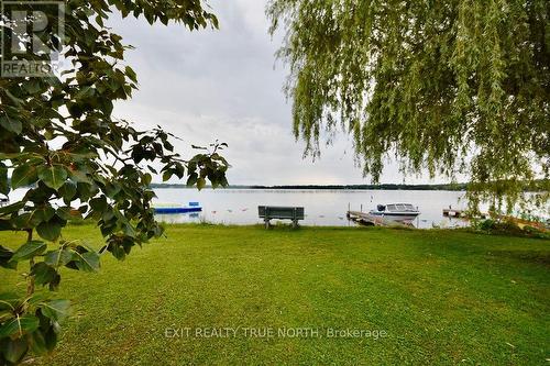 5632 Penetanguishene Road, Springwater, ON - Outdoor With View