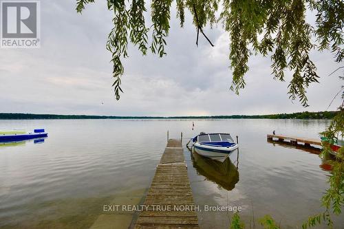 5632 Penetanguishene Road, Springwater, ON - Outdoor With Body Of Water With View