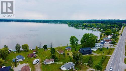 5632 Penetanguishene Road, Springwater, ON - Outdoor With Body Of Water With View