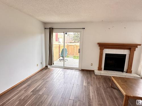 920 Lakewood N Nw, Edmonton, AB - Indoor Photo Showing Living Room With Fireplace