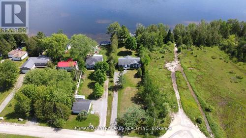 275 Mcguire Beach Road, Kawartha Lakes, ON - Outdoor With Body Of Water With View