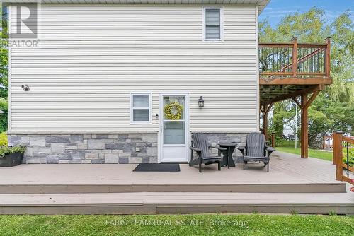 282 Robins Point Road, Tay, ON - Outdoor With Exterior