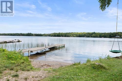 7178 Highway 35, Kawartha Lakes, ON - Outdoor With Body Of Water With View