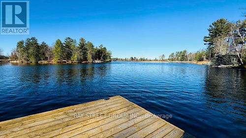 3636 - 6 County Road N, Kawartha Lakes, ON - Outdoor With Body Of Water With View