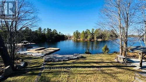 3636 - 6 County Road N, Kawartha Lakes, ON - Outdoor With Body Of Water With View