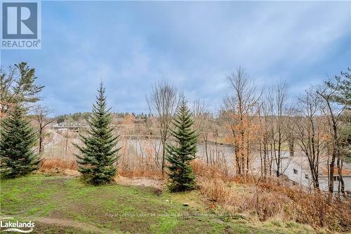 Gl5 - 10B Kimberley Avenue, Bracebridge (Macaulay), ON - Outdoor With View