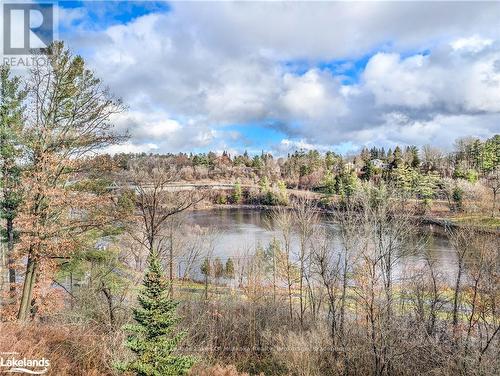 Gl5 - 10B Kimberley Avenue, Bracebridge (Macaulay), ON - Outdoor With View