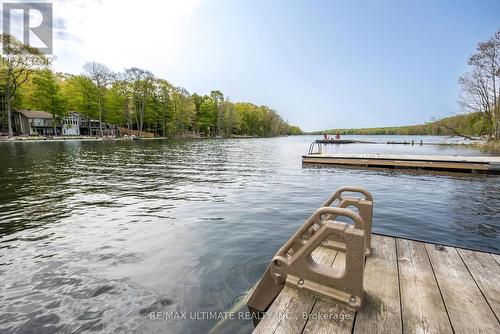 157 Farlain Lake Road W, Tiny, ON - Outdoor With Body Of Water With View