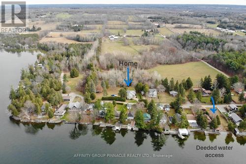 78 Islandview Road, Kawartha Lakes (Fenelon Falls), ON - Outdoor With Body Of Water With View