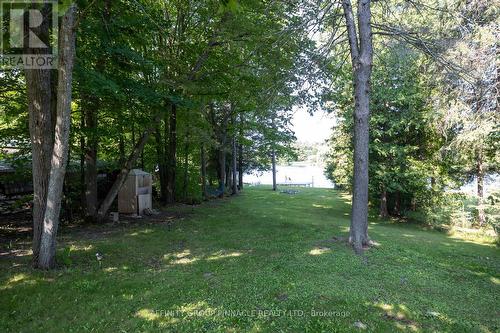 24 Hargrave Road, Kawartha Lakes (Kirkfield), ON - Outdoor