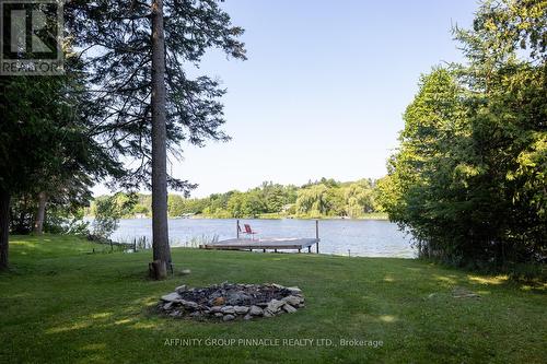 24 Hargrave Road, Kawartha Lakes (Kirkfield), ON - Outdoor With Body Of Water With View